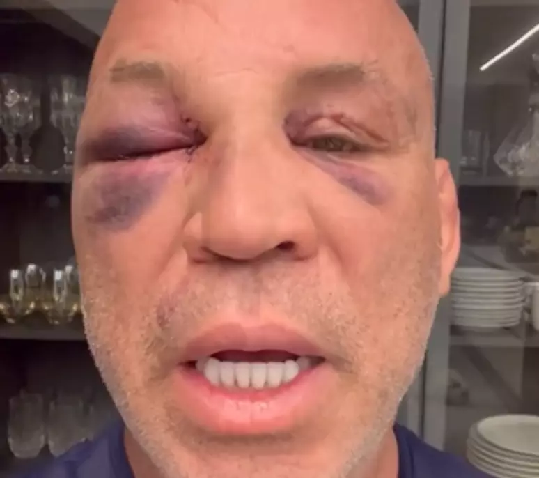 Wanderlei Silva quebra silêncio após desmaio em confusão contra Popó