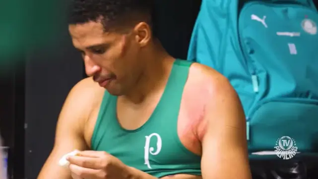 Palmeiras mostra cicatrizes em Murilo por entrada de Carrascal do Flamengo